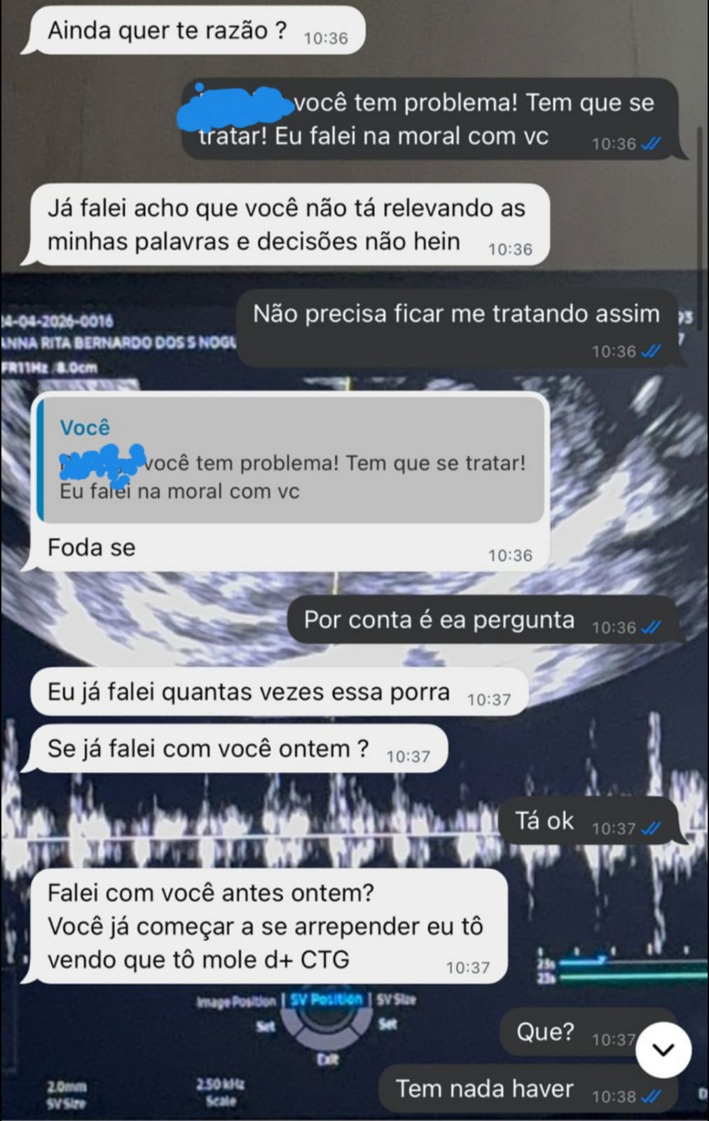Homem é preso em flagrante por violência psicológica contra ex-companheira grávida em Arrozal
