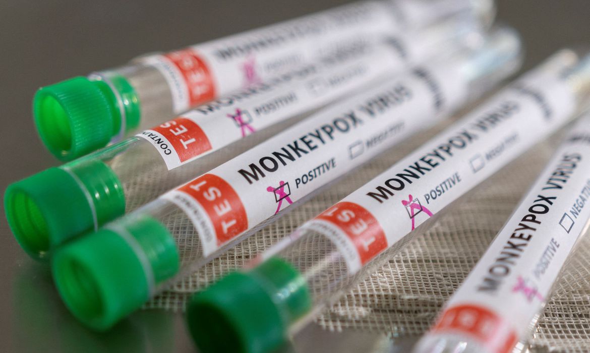 Ministério da Saúde confirma segundo caso de varíola dos macacos no estado do RJ