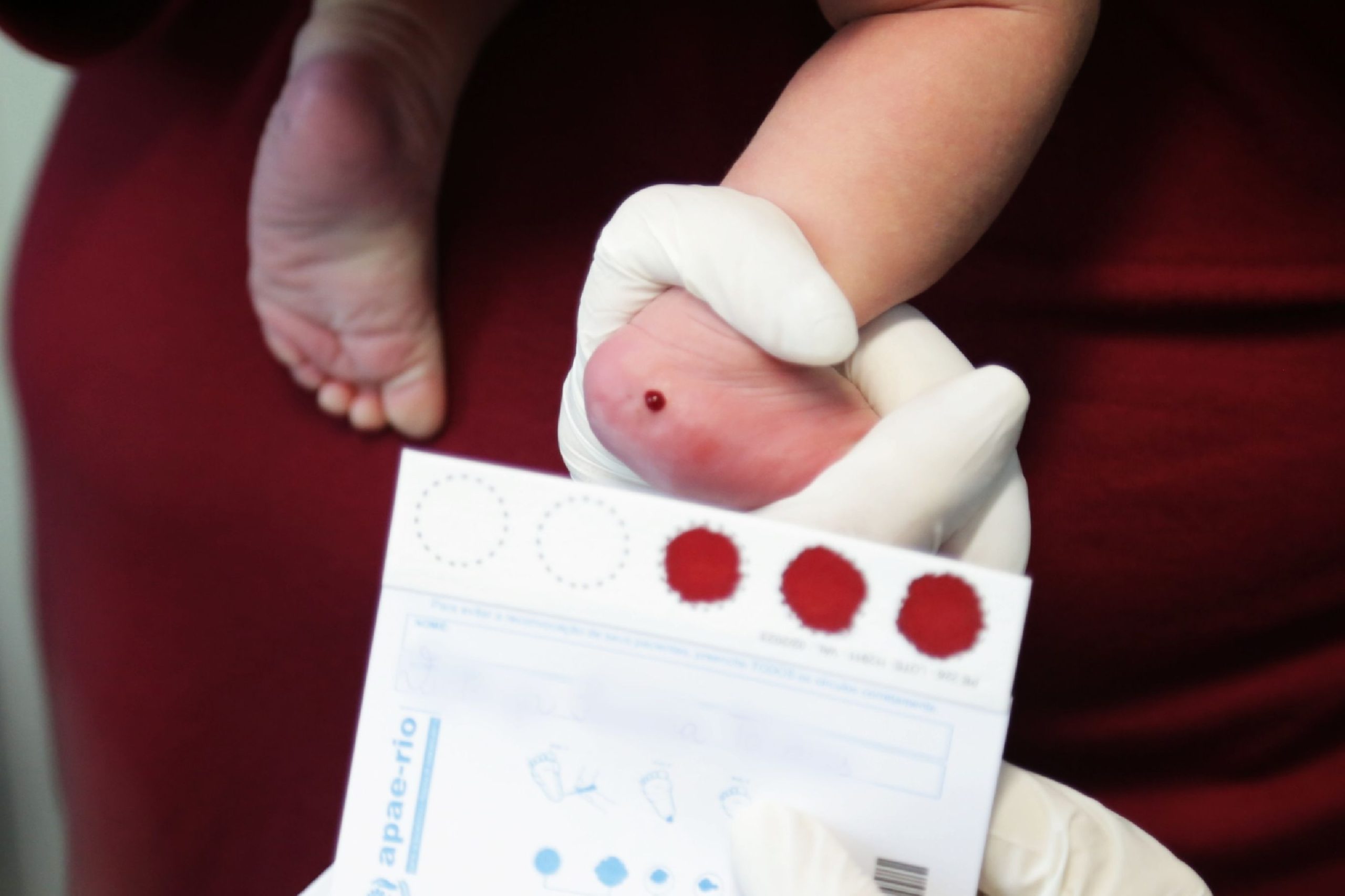 Maternidades e hospitais serão obrigados a informar doenças detectadas no ‘Teste do Pezinho’